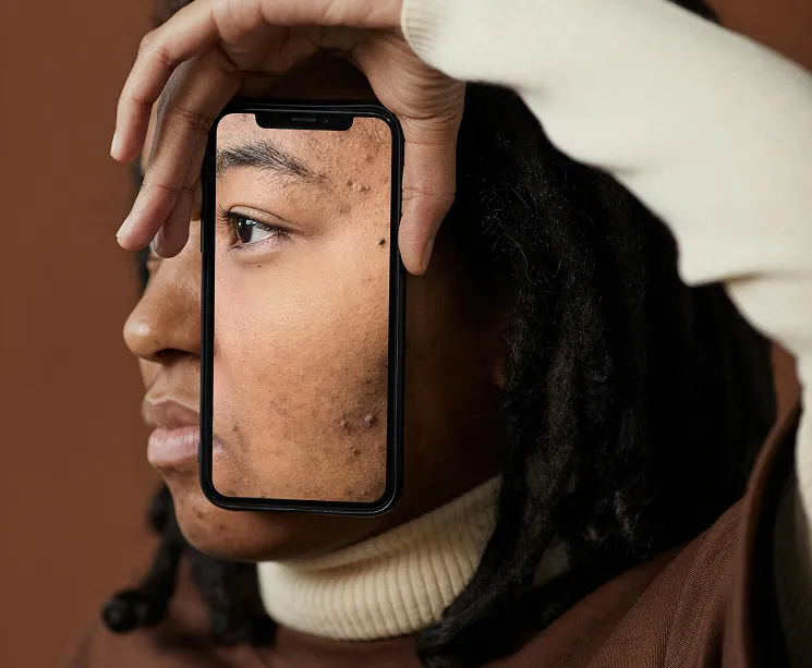 Facial Skin Analysis