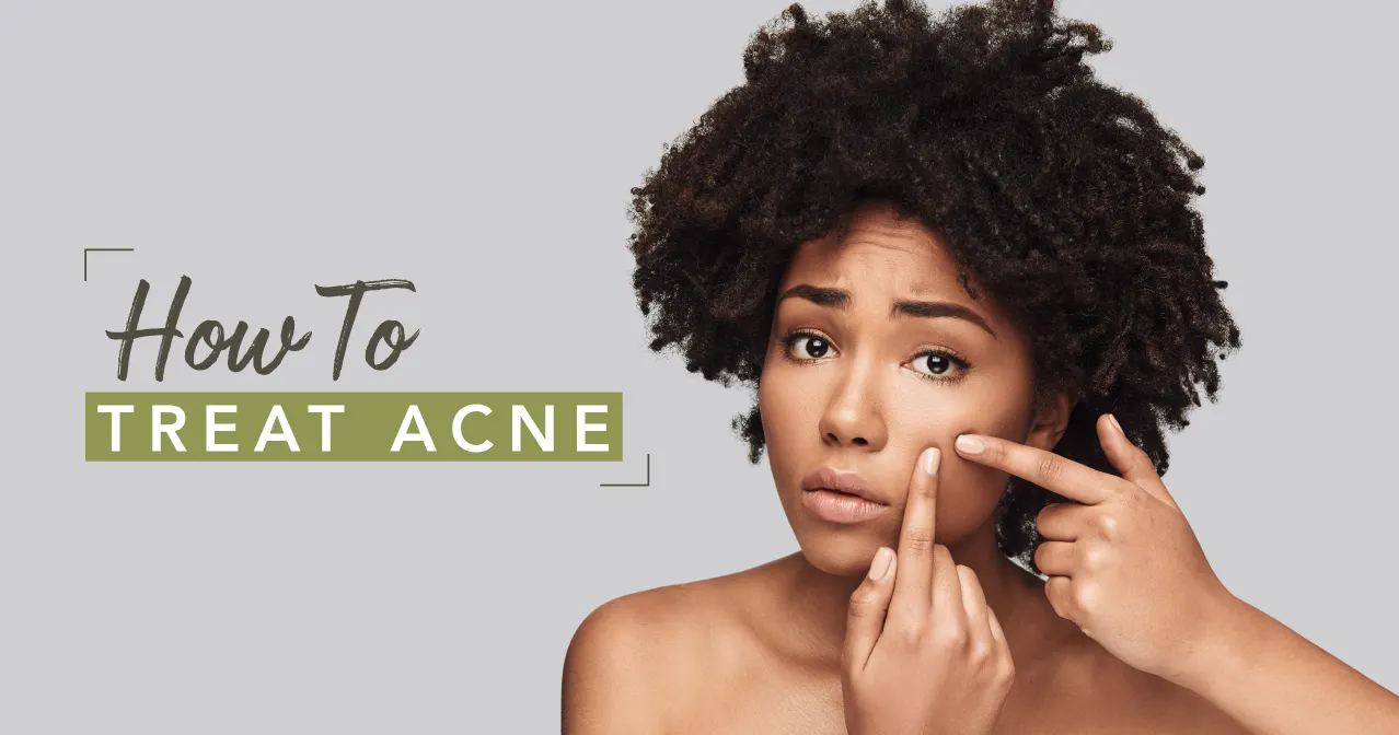 How to Get Rid of Acne Pt. 1