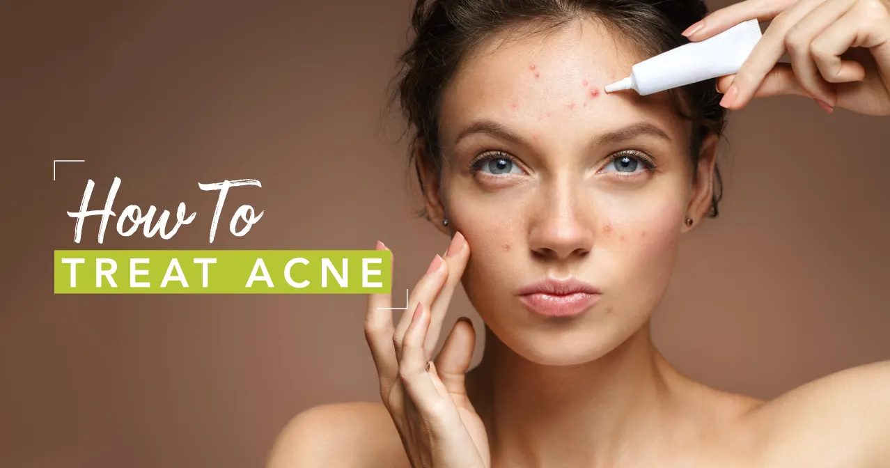 How to Get Rid of Acne Pt. 2 – Acne Routine