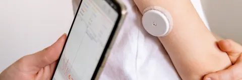 Continuous blood sugar monitors what do they tell us? And what not?